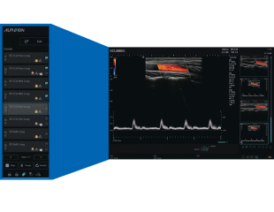 x_assistant_alpinion_Ultraschallgerät_Workflowprotokoll