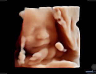 LiveHQ von Alpinion_Ultraschallgerät für die Geburtshilfe