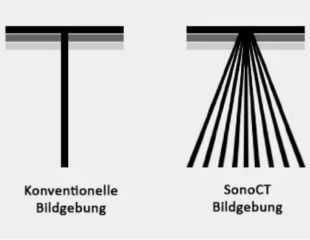 SonoCT von Philips Ultraschallgeräte