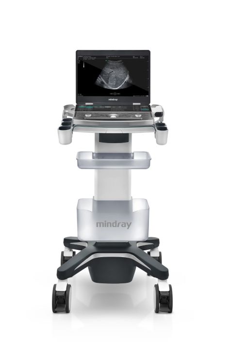 mindray_mx7 portabels Ultraschallgerät auf Gerätewagen