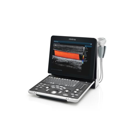mindray_z60_portables-farbdoppler-ultraschallgeraet